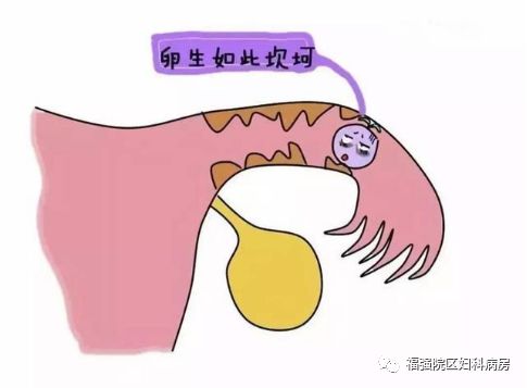 卵生如此坎坷