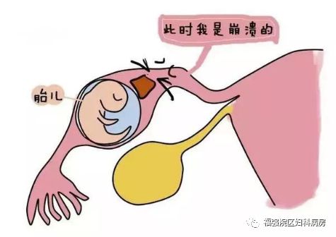胎儿